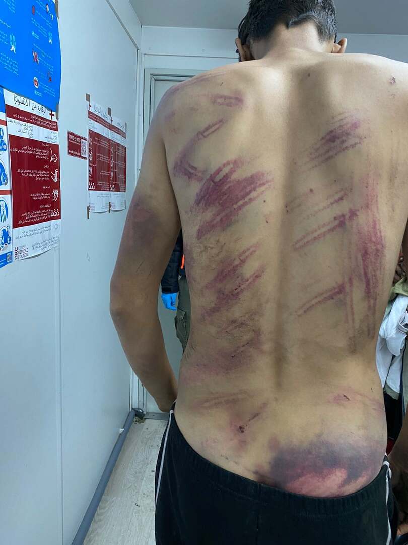 Njemačka osudila ponašanje hrvatskih policajaca - slika 1